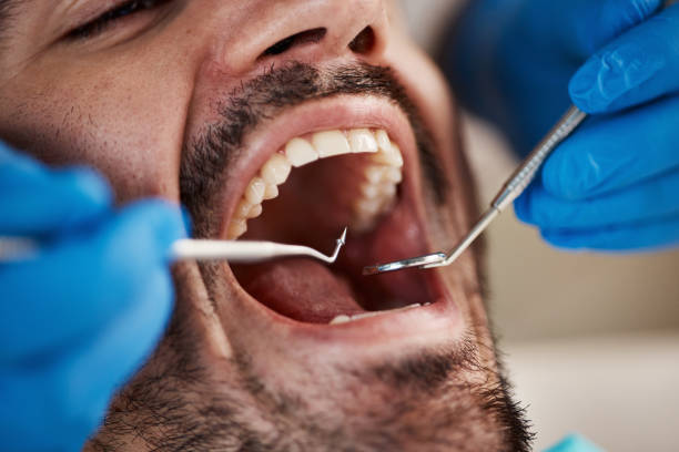 Best Emergency TMJ Treatment in Stroville, CA